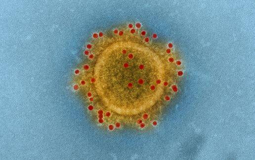 Coronavirus : pour un spécialiste russe des maladies infectieuses, « le plus grand danger est psychologique »