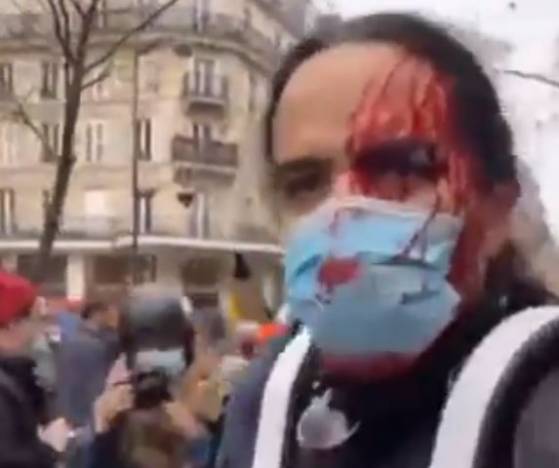 Manifestation à Paris: BFMTV affirme qu'un homme en sang blessé lors d'une charge de police est en réalité "maquillé", et rectifie son information 3 heures plus tard (Vidéo)